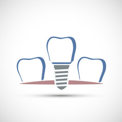 Logo dental implant. Isolated on white background