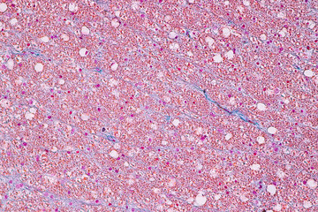 Education anatomy and Histological sample Spinal cord Tissue under the microscope.