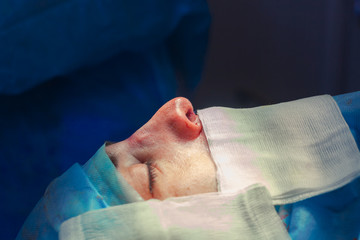 Surgeon and his assistant performing cosmetic surgery on nose in hospital operating room. Nose...