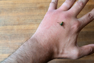 Male hand stung by bee or wasp. Hand swelling, inflammation, redness are signs of infection. Insect bite on left hand on wooden table background