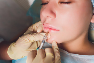Lip Augmentation. Beautiful Young Woman's Mouth Receiving Hyaluronic Acid Injection. Closeup Of...