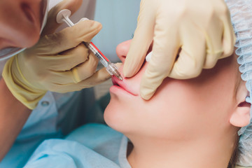 Lip Augmentation. Beautiful Young Woman's Mouth Receiving Hyaluronic Acid Injection. Closeup Of...