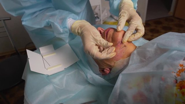 Aged woman doing mesothreads and Thread Lifting, Cosmetology. Cosmetic procedure to eliminate signs of aging. Beauty Face, Facial contour, plastic surgery concept for Age 70-80 years.