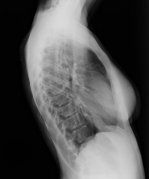 X-ray of a small dog in the vet