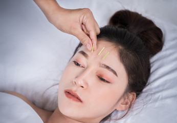 Fototapeta na wymiar woman undergoing acupuncture treatment on head