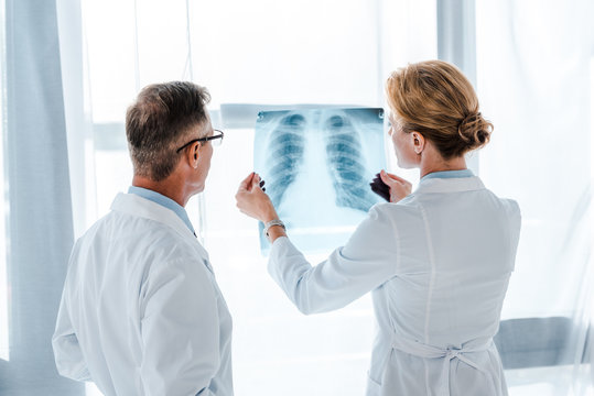 doctor in glasses looking at x-ray in hands of coworker