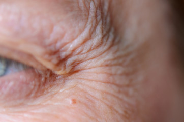 Naklejka premium Close-up details of the crows feet and wrinkled skin around the eye.