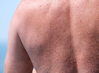 The back of a man with water drops as a background