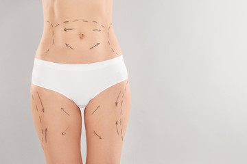 Woman with marks on body for cosmetic surgery operation against grey background, closeup