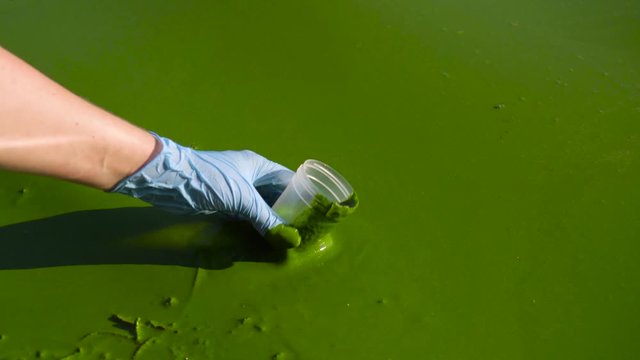 closeup of hands in medical gloves taking samples of green algae in container