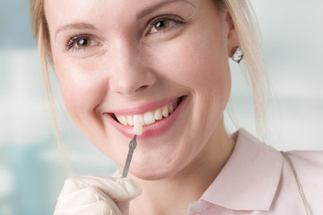 dentist using shade guide at woman's mouth to check veneer of teeth for bleaching