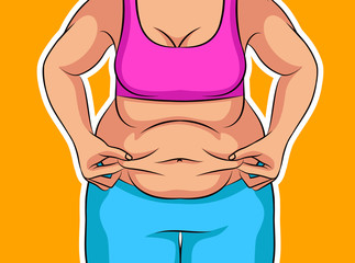 Color vector illustration of a girl before weight loss. Fat female belly. Poster about unhealthy diet and lifestyle. Obese female figure
