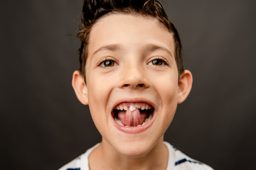 Boy with baby tooth. Child with freshly fallen tooth. Funny kid with baby teeth.