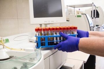 Biochemical laboratory. the technician hand puts a blood test tubes in the stand. Close-up of a blood tube held by a gloved hand 