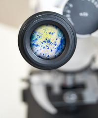 View in the microscope on Trichomonas painted with methylene blue, cytological smear. Selective focus on the eyepiece.