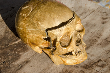 skull human older woman part of body death halloween