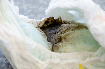 dirty diaper with poop on a white background in hands and close