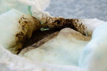 dirty diaper with poop on a white background in hands and close