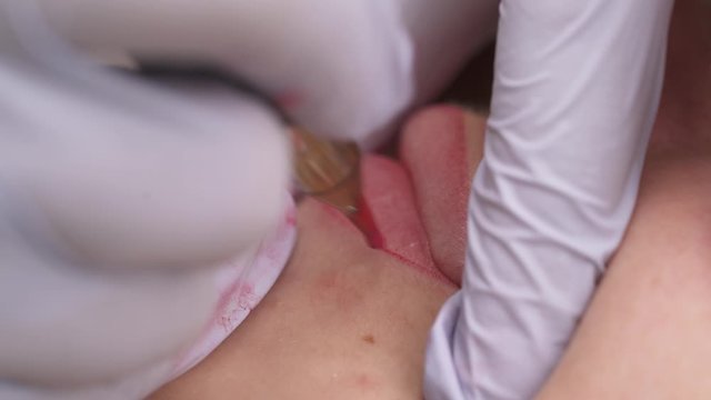 Skilled cosmetologist applying permanent make-up on lips in a beauty salon. Close-up of patients lips during the procedure of lip dermapigmentation with tattoo machine.