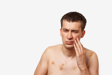 Brunette man with bruises on his body holds his hand to his head in pain after a fight on a white...