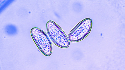 Microscopic image of the eggs of a pinworm (enterobias vermicularis), a parasite common in small...