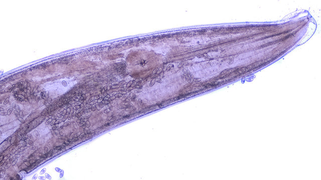 Microscopic image (whole mount prep) of a pregnant pinworm, scientific name Enterobias vermicularis, filled with eggs.