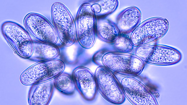 Microscopic image of the eggs of a pinworm (enterobias vermicularis), a parasite common in small school children and associated with an itchy anus. 