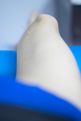 EPI dry needling ultrasound scan