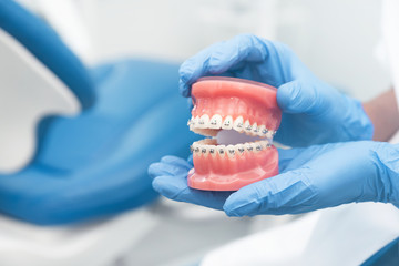Fototapeta na wymiar Dentist holding jaw model, orthodontics concept