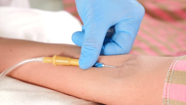 Healthcare concept. Female Hospital Patient left Hand with IV Intravenous Fluid Drip Tube Implanted in Vein For Treatment Drug Delivery During Emergency in Surgery. Doctor adjusts needle position