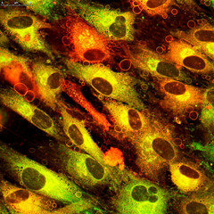 Localization of ceramides in human cultured skin cells. Real photo from a microscope. Photo may contain artifacts due to fluorescent staining.