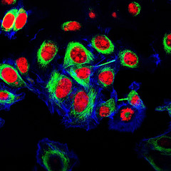 HeLa cells labeled with fluorescent dyes