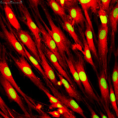 Fibroblast cells. Confocal light micrograph of mammalian fibroblast cells. 