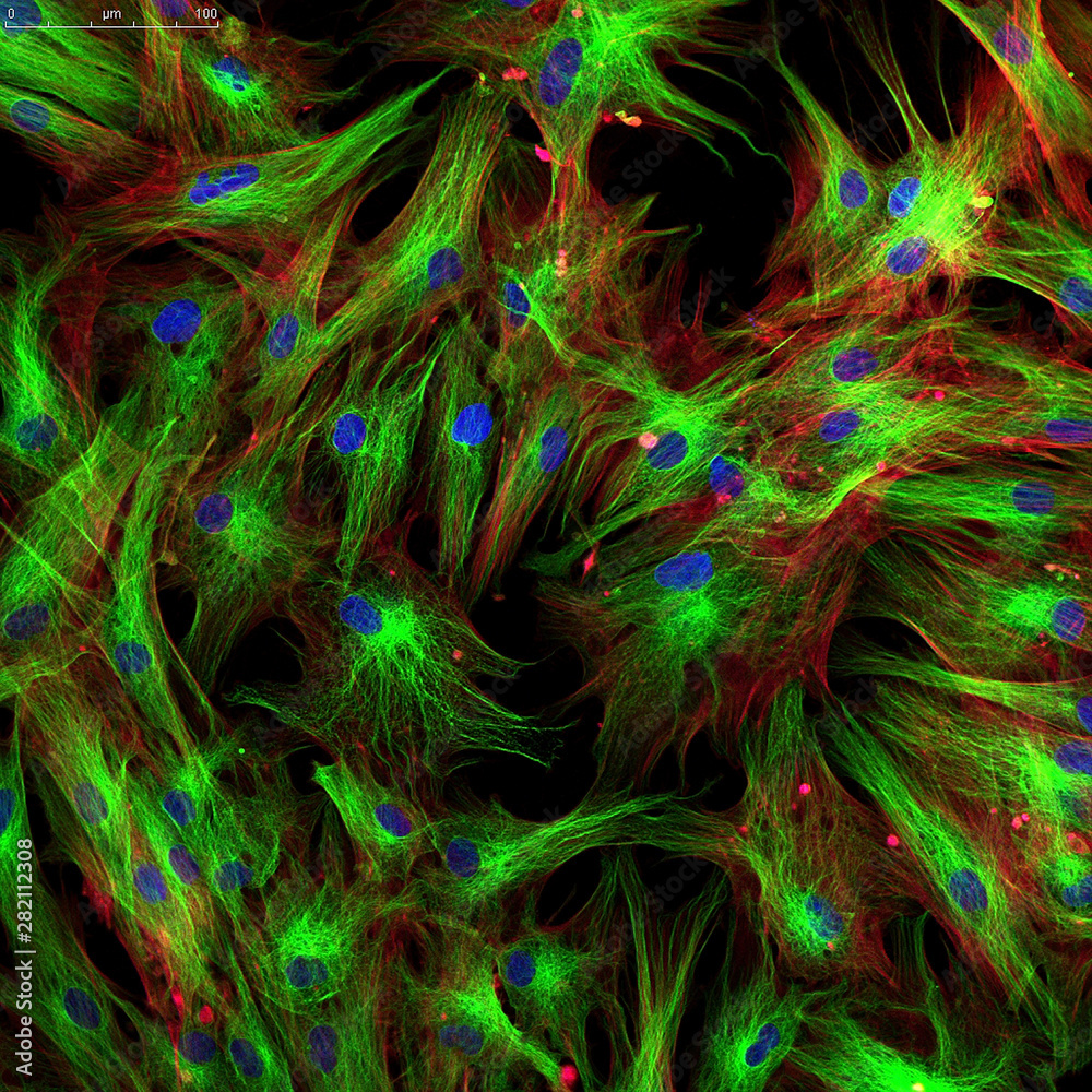 Wall mural Fibroblast cells. Confocal light micrograph of mammalian fibroblast cells. 