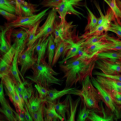 Fibroblast cells. Confocal light micrograph of mammalian fibroblast cells. 