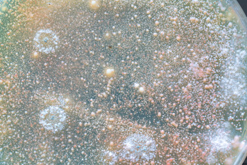 Colonies of fungi and bacteria on agar in a petri dish