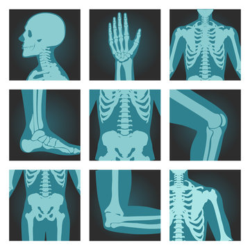 Set of x-ray shots pictures of human body parts, head, wrist, rib cage, foot, spine, knee, cubit, shoulder, vector illustration.