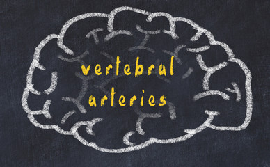 Drawind of human brain on chalkboard with inscription vertebral arteries