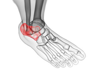 Obraz premium 3d rendered medically accurate illustration of the calcaneus bone