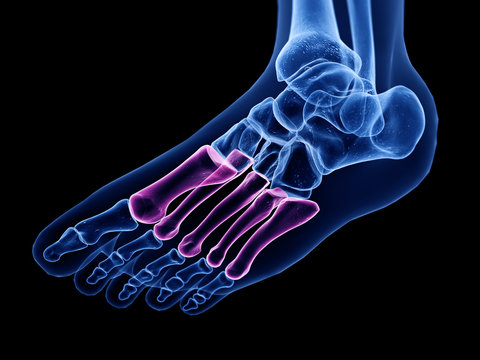 3d rendered medically accurate illustration of the metatarsal bone