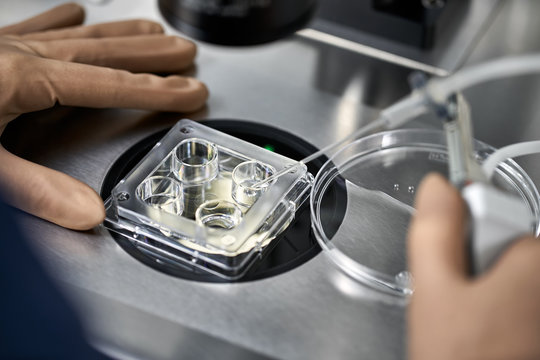 Process of in vitro fertilization in laboratory