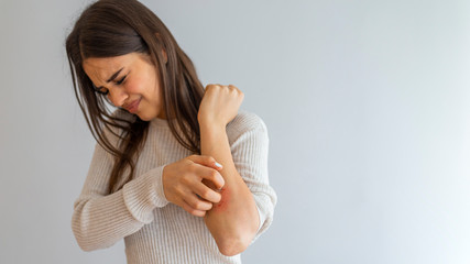 Young woman scratching arm from having itching on white background. Cause of itchy skin include...