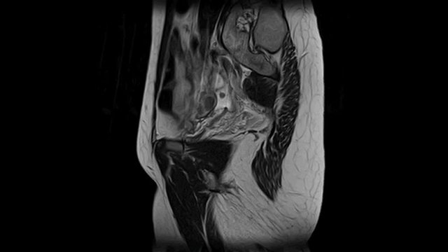 Contrast MRI scan of the abdominal cavity and retroperitoneal space, detection of pathologies