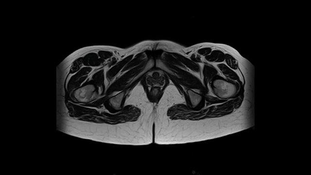 Retroperitonealraum Bilder Durchsuchen 21 Archivfotos,