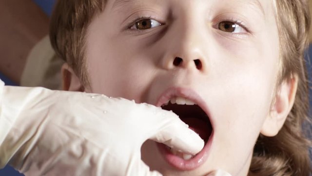 Dentist tries to extract primary shaky tooth at boy of six years. Closeup