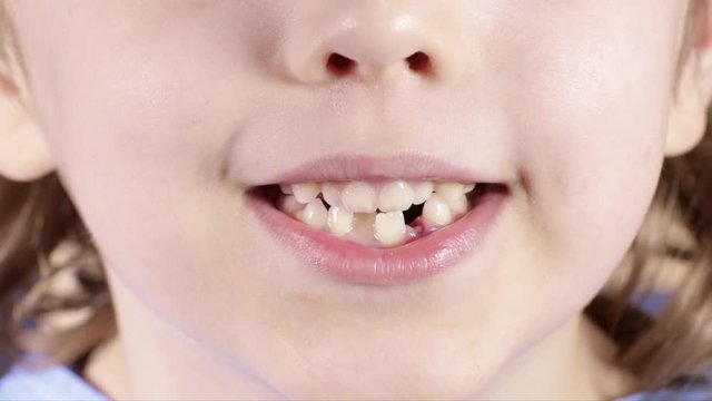 Smiling boy of six years breaths through the mouth. Closeup