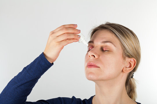 Woman with severe eye infection