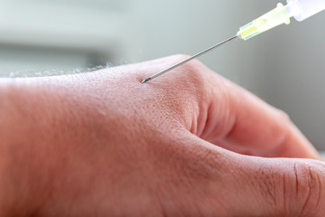 Neues Heilmittel wird als Medikament per Spritze in den Arm eines kranken Patienten injiziert und...
