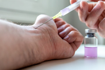Coronavirus-Therapie: Neues Heilmittel wird als Medikament per Spritze in den Arm eines kranken...