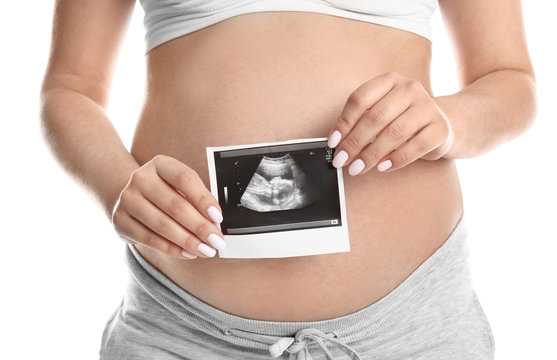 Pregnant woman with ultrasound picture on white background, closeup